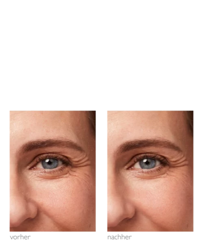 Rosé Effect Eye Cream